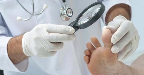 tratamiento de hongos en los pies por parte de un médico